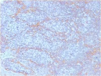 Formalin-fixed, paraffin embedded human tonsil sections stained with 100 ul anti-Beta Catenin (clone CTNNB1/2098) at 1:50. HIER epitope retrieval prior to staining was performed in 10mM Citrate, pH 6.0.